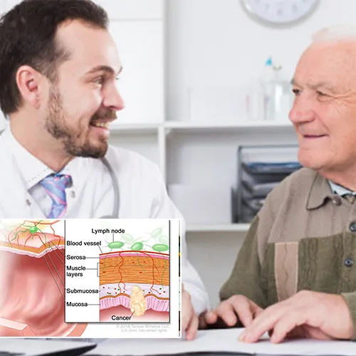 The Journey of 3D Printing in Penile Prosthesis