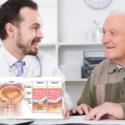 Why Choose   Urology San Antonio

for Your Penile Implant?