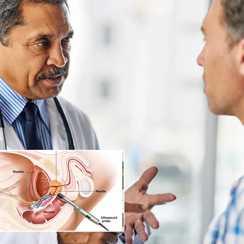 The Procedure: What to Expect with   Urology San Antonio
