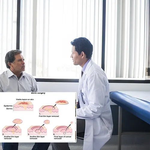 Choosing   Urology San Antonio

for Your Penile Implant